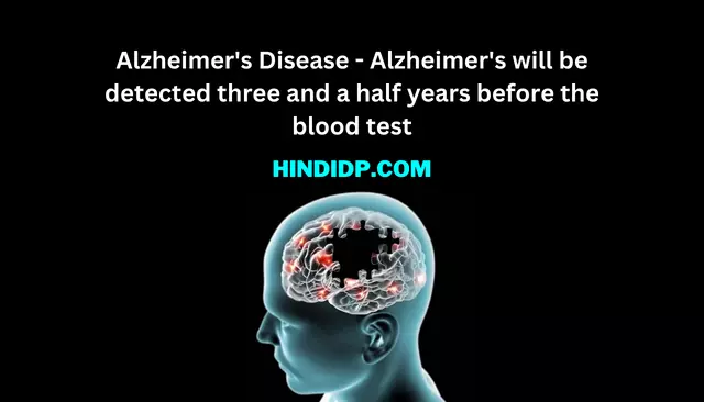 Alzheimer's Disease - Alzheimer's will be detected three and a half years before the blood test